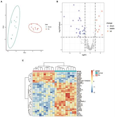 Bioinformatics identification of ferroptosis-related genes and therapeutic drugs in rheumatoid arthritis